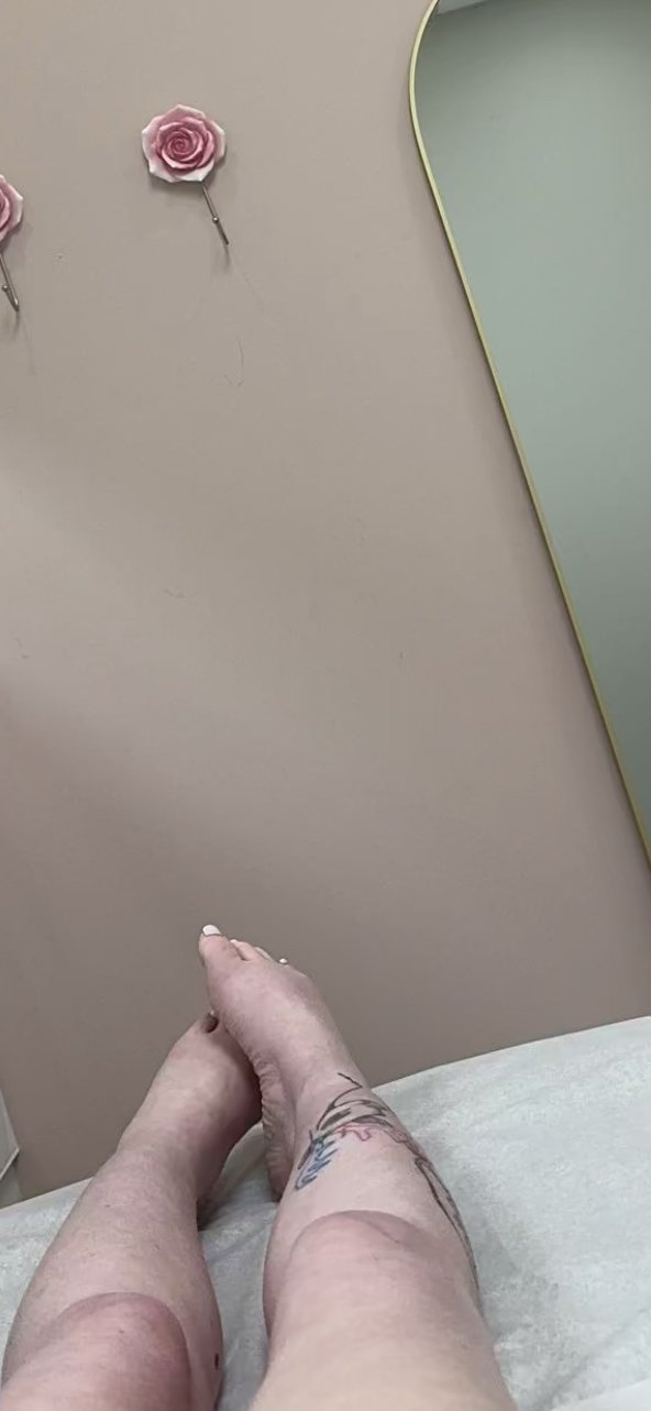 Albino twerking and feet teasing #rbXCj6FO